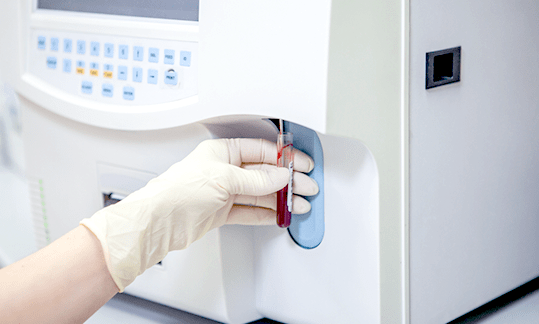 may xet nghiem mau hien dai