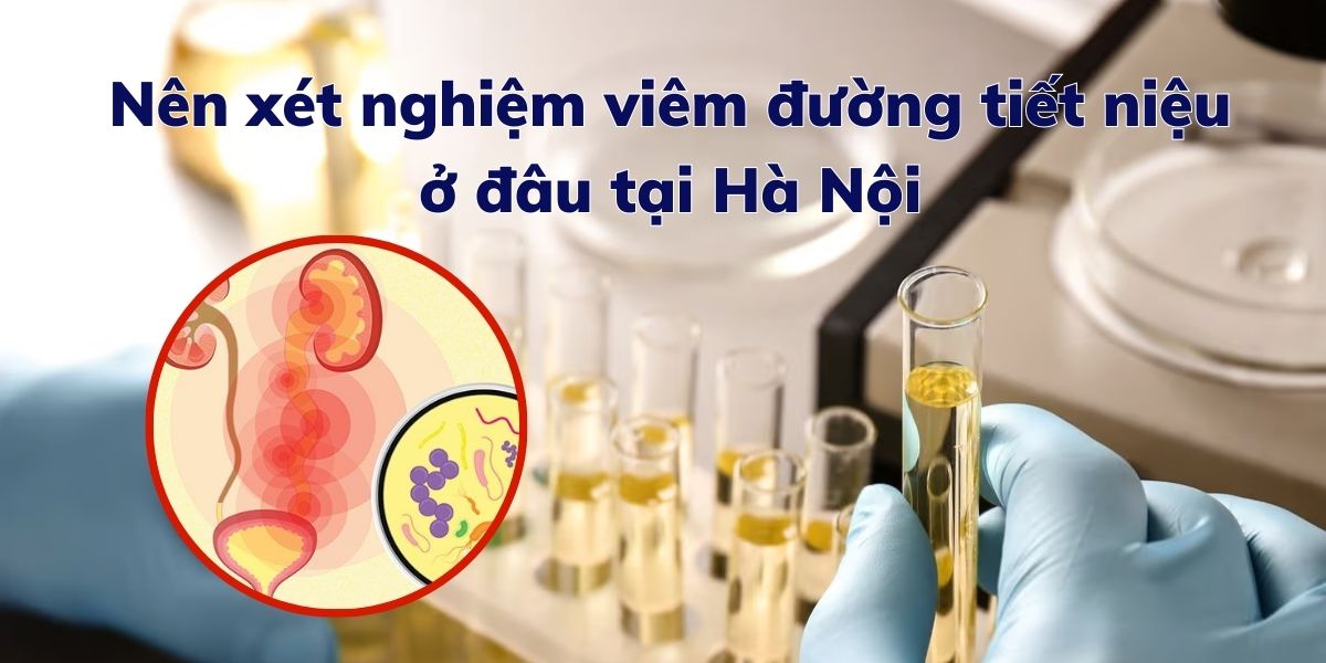Nên xét nghiệm viêm đường tiết niệu ở đâu tại Hà Nội