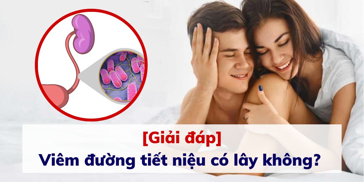 [Giải đáp] Bệnh viêm đường tiết niệu có lây không? 