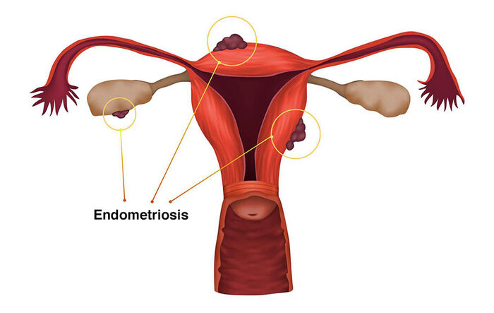 Endometrial optimism