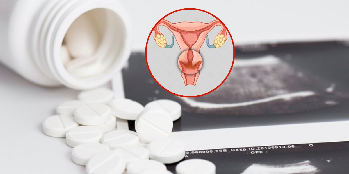Viêm cổ tử cung có phá thai được không? 