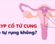 polyp-co-tu-cung-co-tu-rung-khong-muc-do-nguy-hiem-cua-benh