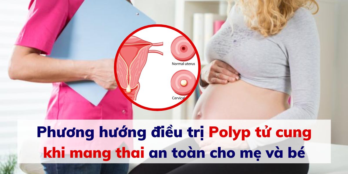 điều trị Polyp tử cung khi mang thai an toàn
