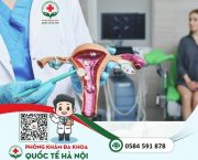 benh-buong-trung-o-phu-nu