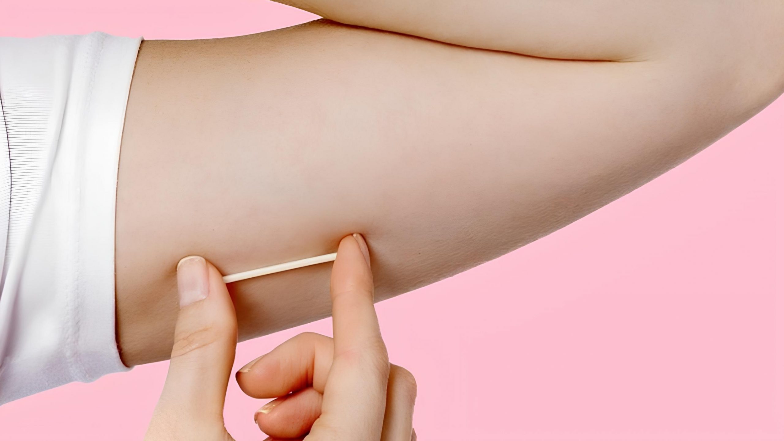 Que cấy tránh thai 