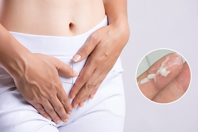 Khí hư ra nhiều hơn, trắng đục sau khi đặt thuốc