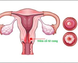 bi-viem-co-tu-cung-co-mang-thai-duoc-khong