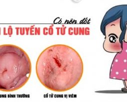 dot-viem-lo-tuyen-co-mang-thai-duoc-nua-khong