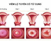 ra-khi-hu-mau-vang-xanh-co-nguy-hiem-khong