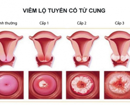 ra-khi-hu-mau-vang-xanh-co-nguy-hiem-khong