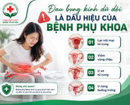 dau-bung-kinh-du-doi-co-phai-dau-hieu-benh-phu-khoa-khong