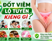 dot-viem-lo-tuyen-kieng-gi