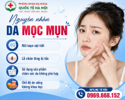 cham-soc-da-mun