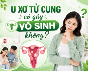 u-xo-tu-cung-co-gay-vo-sinh-khong