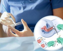 khi-nao-can-lam-xet-nghiem-hpv-tam-soat-ung-thu-co-tu-cung