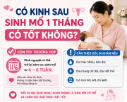 co-kinh-sau-sinh-mo-1-thang-co-tot-khong