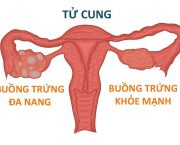 da-nang-buong-trung-co-chua-khoi-duoc-khong
