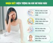khi-hu-mau-nau-canh-bao-dieu-gi