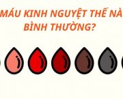 mau-mau-kinh-nguyet-the-nao-la-binh-thuong