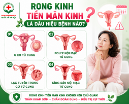 rong-kinh-tien-man-kinh-co-nguy-hiem-khong