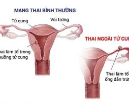 thai-ngoai-tu-cung-co-ra-mau-khong