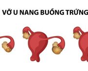 u-nang-buong-trung-co-vo-khong