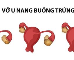 u-nang-buong-trung-co-vo-khong
