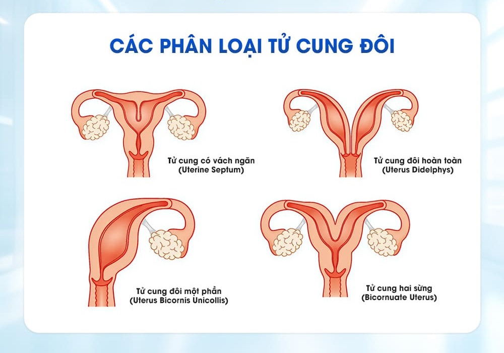 Các bất thường tại tử cung